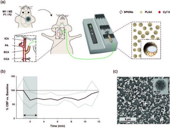 Endovascular administration of magnetized nanocarriers targeting brain delivery after stroke