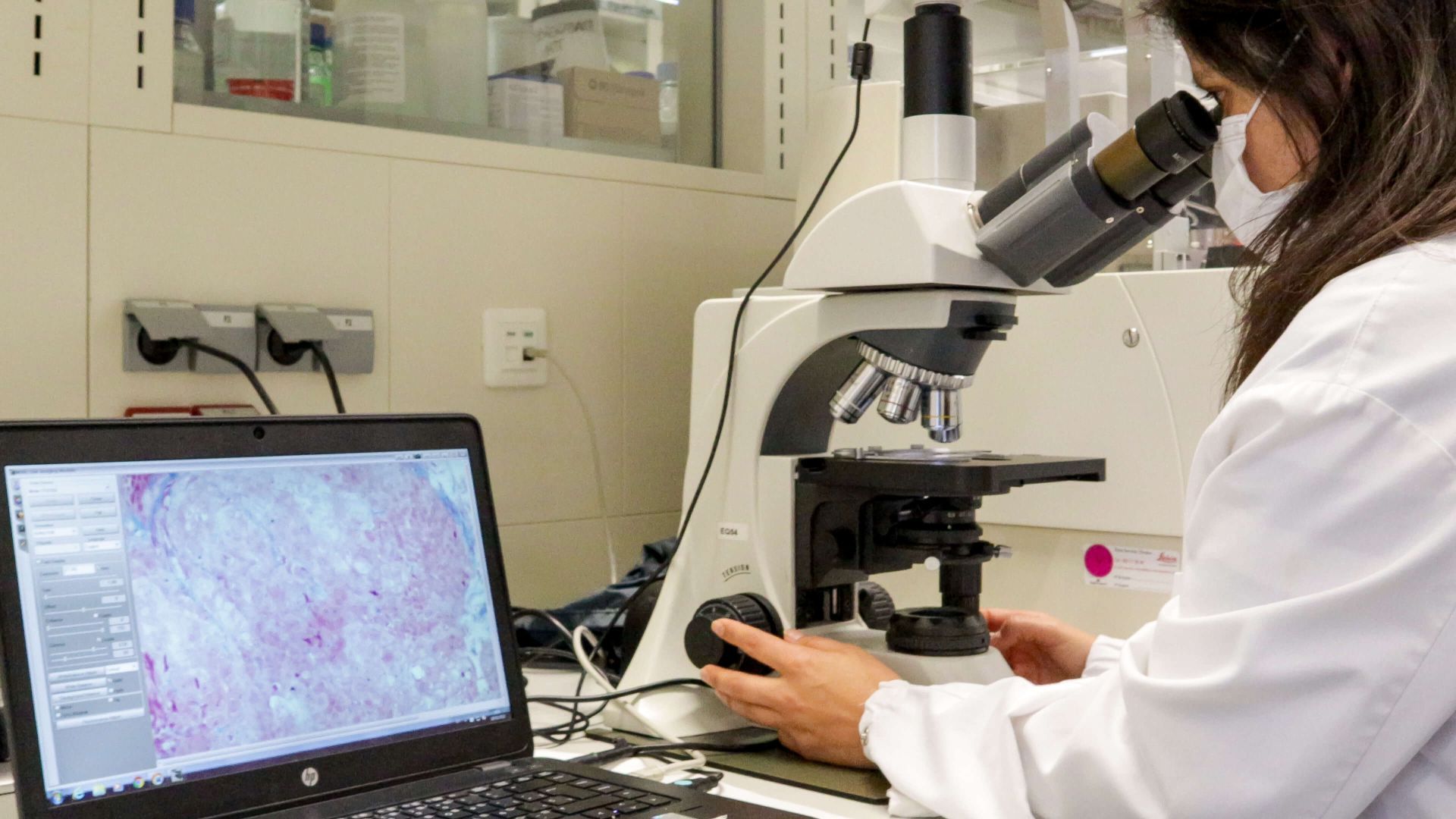 Smart4Fabry Lab in VHIR | ICMAB