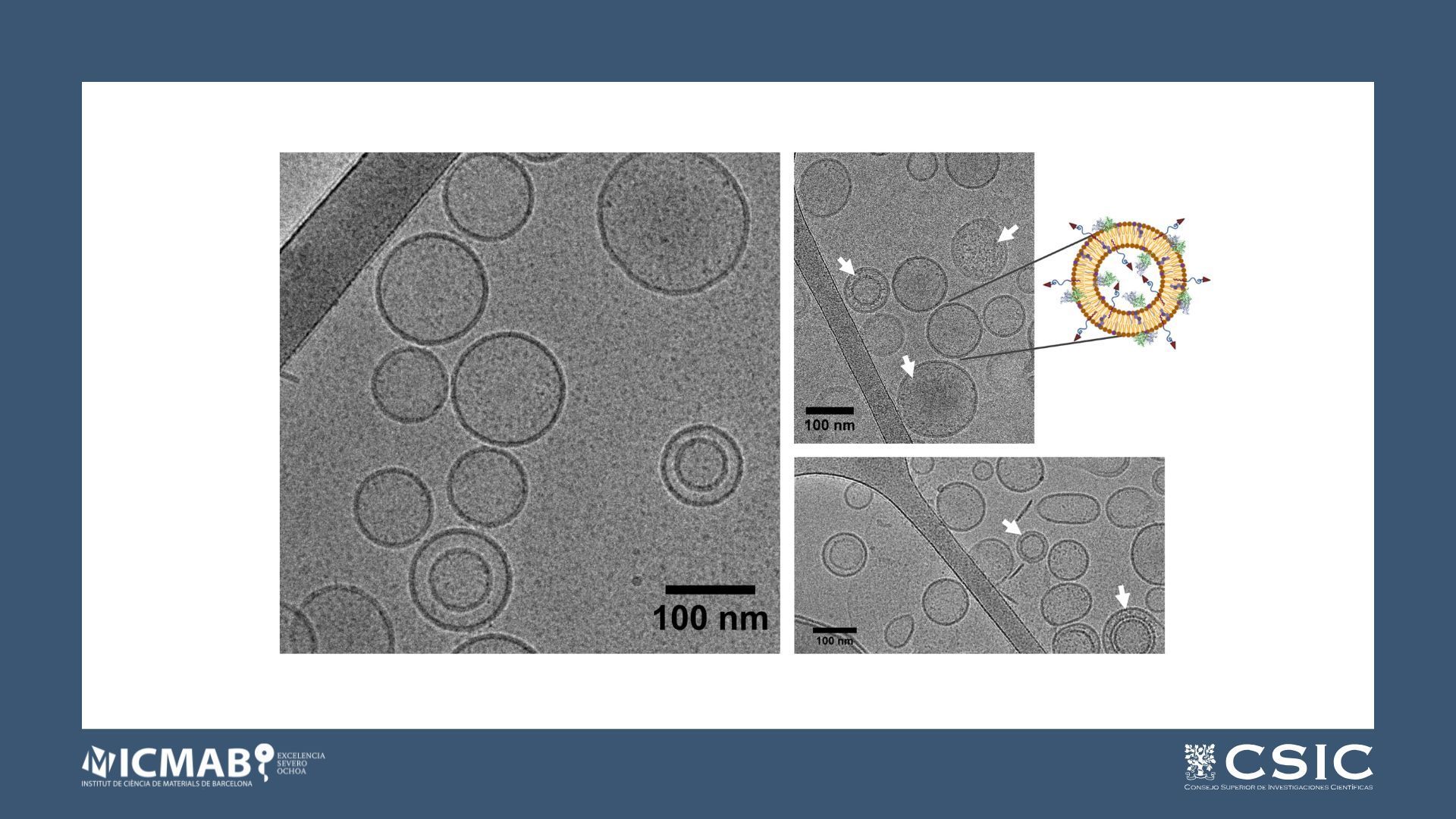 Targeted nanoliposomes to improve enzyme replacement therapy of Fabry disease