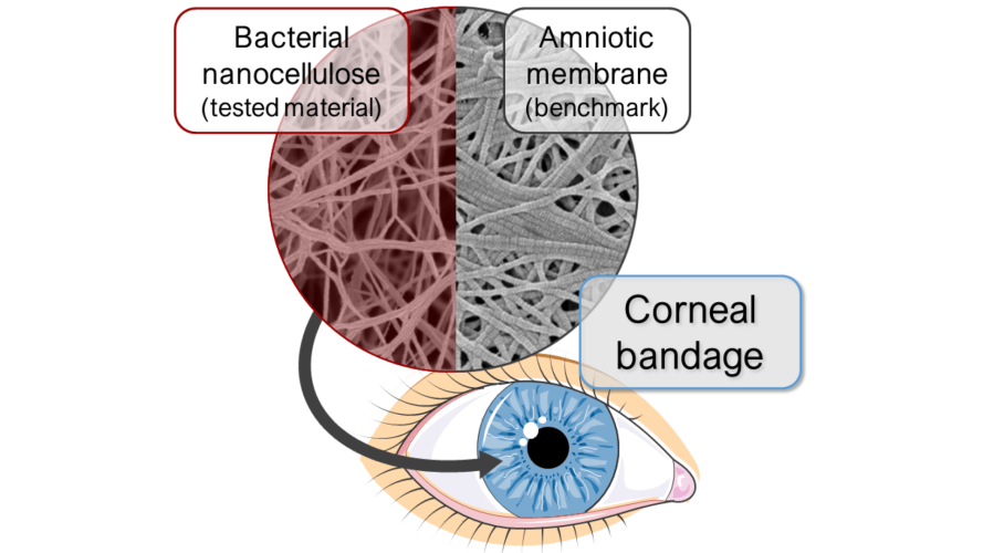 Bacterial nanocellulose as a corneal bandage material: A comparison with amniotic membrane