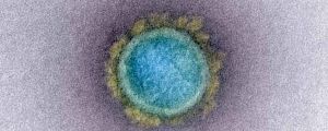 Image: Electron microscopy image of a typical SARS-CoV-2 coronavirus particle, freely distributed by the NIAID’s Rocky Mountain Laboratories (NIAID-RML),1 colored to emphasize the virus structure.