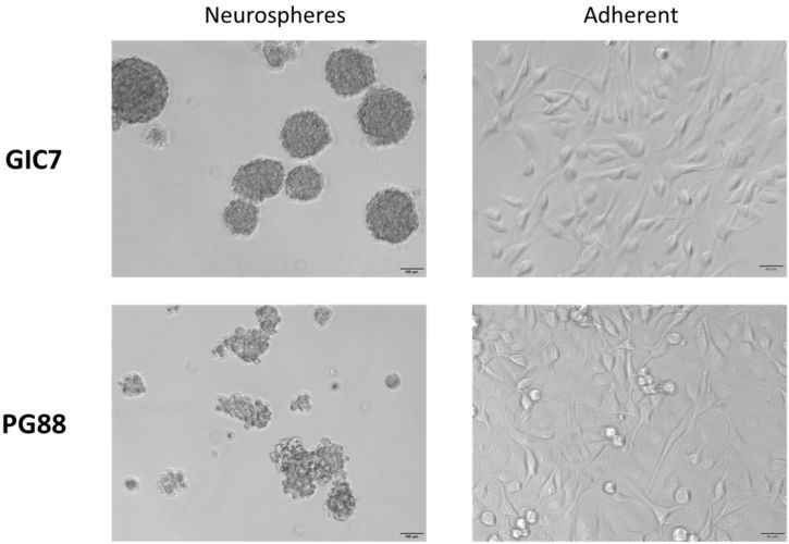 Synchrotron-Based Fourier-Transform Infrared Micro-Spectroscopy (SR-FTIRM) Fingerprint of the Small Anionic Molecule Cobaltabis (dicarbollide) Uptake in Glioma Stem Cells