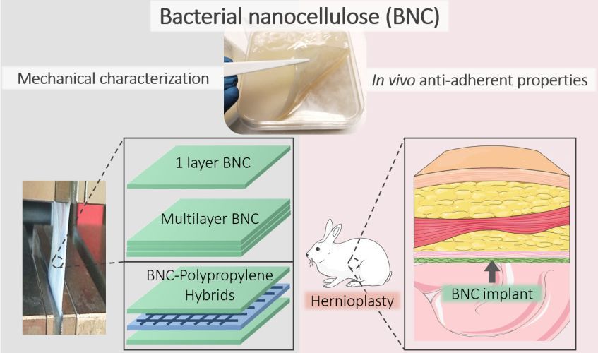 In vivo soft tissue reinforcement with bacterial nanocellulose