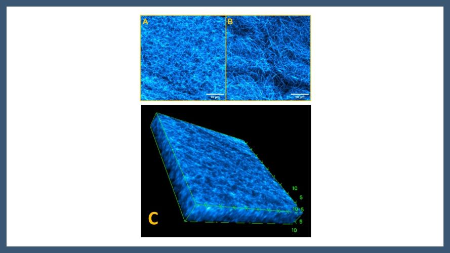 Visualizing nanostructures in supramolecular hydrogels: a correlative study using confocal and cryogenic scanning electron microscopy